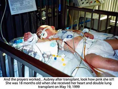 A baby in a hospital bed with oxygen masks on.
